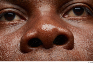 HD Face Skin Izik Wangombe face nose skin pores skin…